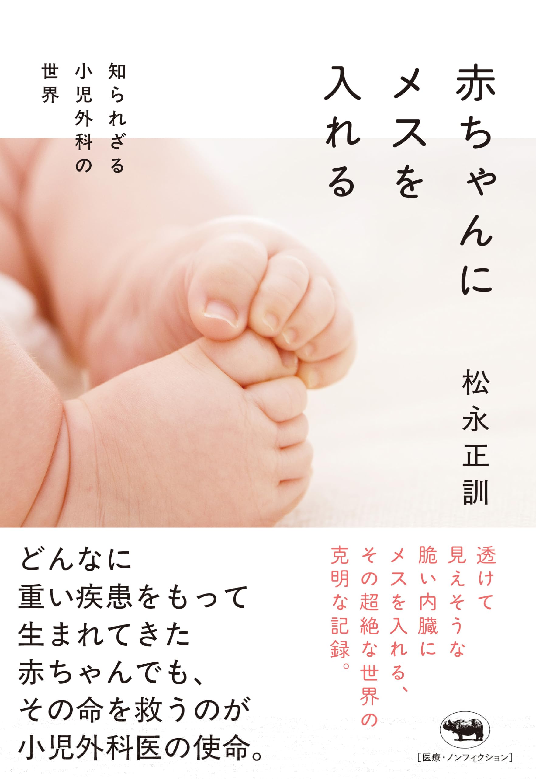 赤ちゃんにメスを入れる　知られざる小児外科の世界 